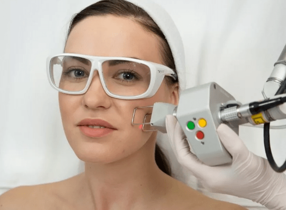 Rejuvenarea laserului de câmp