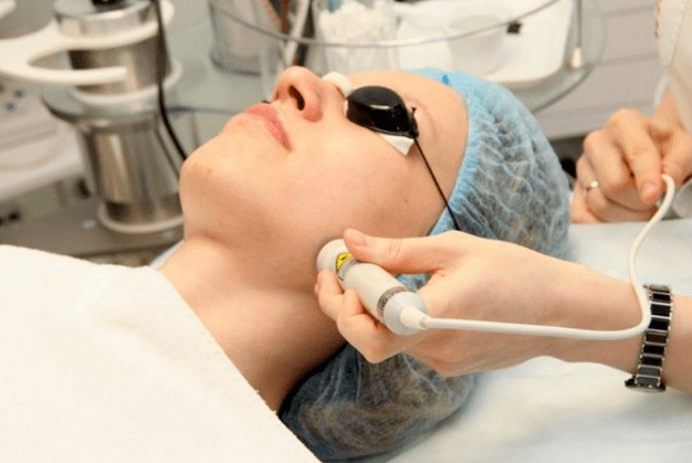 Biorevitalizare laser