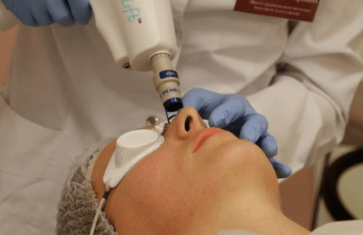 Întinerirea laserului care nu poate